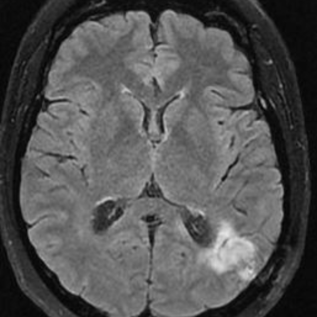 NeuroimagingN's tweet photo. https://t.co/xhUwMzW8SS