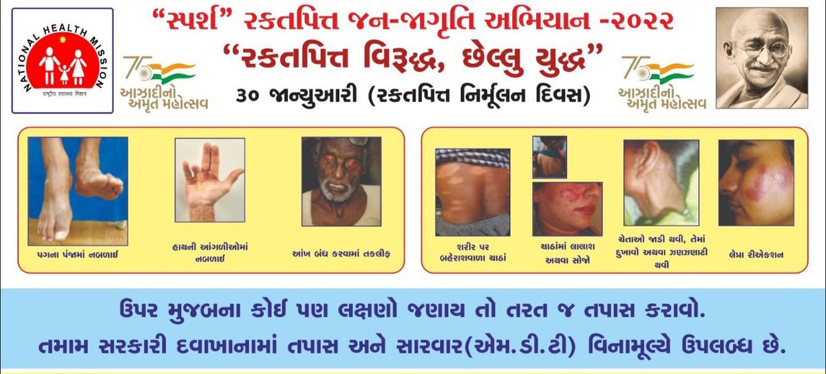 THORAJULA's tweet photo. સ્પર્શ #Leprosy અવેરનેસ કેમ્પેઈન અંતર્ગત @SdmRajula ના અધ્યક્ષ સ્થાને કો-ઓરડીનેશન કમિટીની મિટીગ કરી ગ્રામસભાના આયોજન સાથે કામગીરીની શરૂઆત કરી તેમજ તા.૧૩/૨/૨૩ સુધી જનજાગૃતિ અભિયાન ચલાવાશે
#IEC #SBCC
@GujHFWDept @mdnhmgujarat @CollectorAmr @ddoamreli @AmreliHealth @ArunKumar23302 https://t.co/9QVv4sSCZG