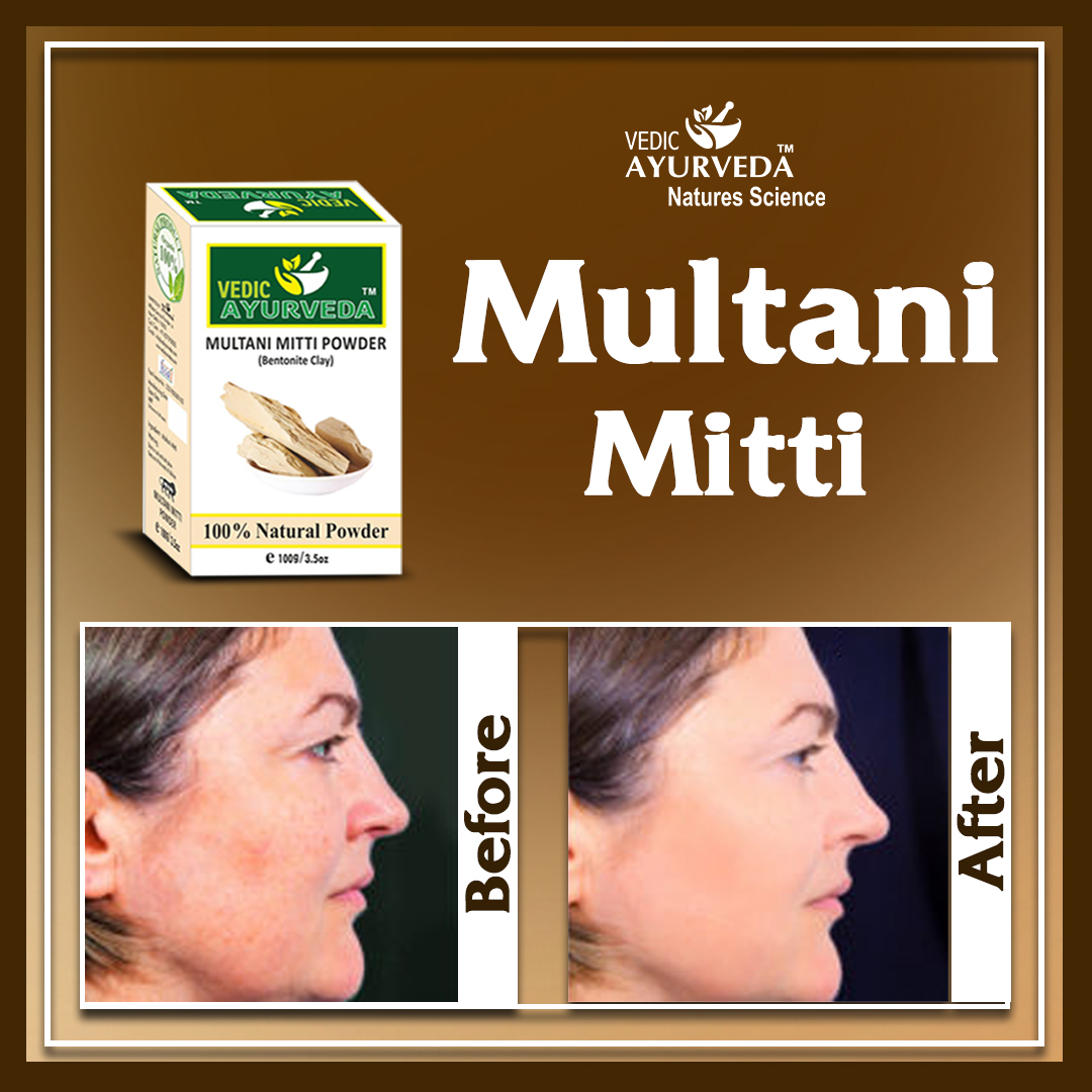 VedicAyurveda01's tweet image. Multani Mitti Powder... (Balancing And Brightening Skin Tone)
vedicayurvedas.com/products/powde…
#multanimitti #multanimittipowder  #skincare #multanimittifacepack #powder #facecare #skincareroutine #skincareofficial #beforeafter #skin  #exploremore #likesoflikes #instagram #ecommerce