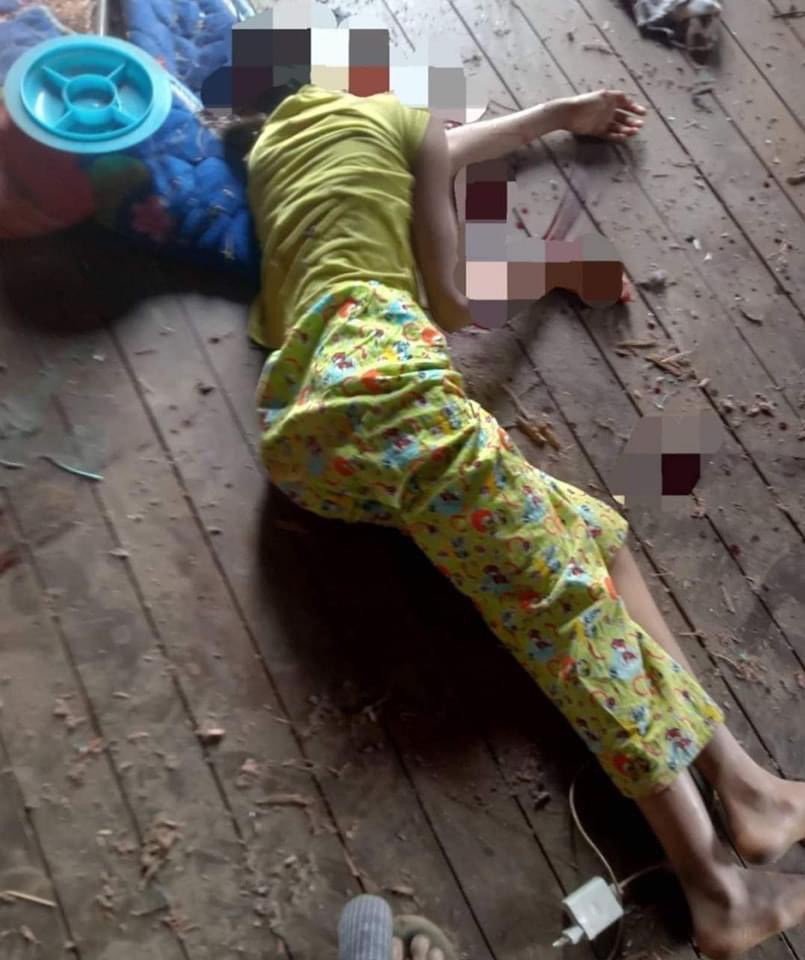 ArakanBaynews's tweet photo. A twelve-year-old girl has been killed and a thirteen-year-old boy wounded by the junta’s artillery shells in Kathar township, Sagaing. They are siblings.
#Crimesagainsthumanity #MMarmy #Kathar #Sagaing #Myanmar #MMarmywarcrimes https://t.co/HFKA5OuX2T