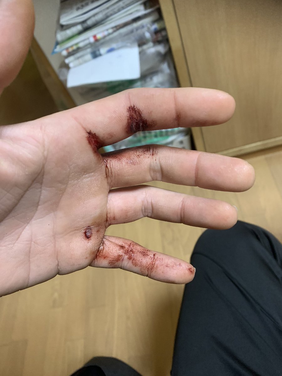 奈良西警察署の刑事に
暴行受けた😆

なにもしてないのに
お前なんか眼中にないとか言われた
捕まれよまじで