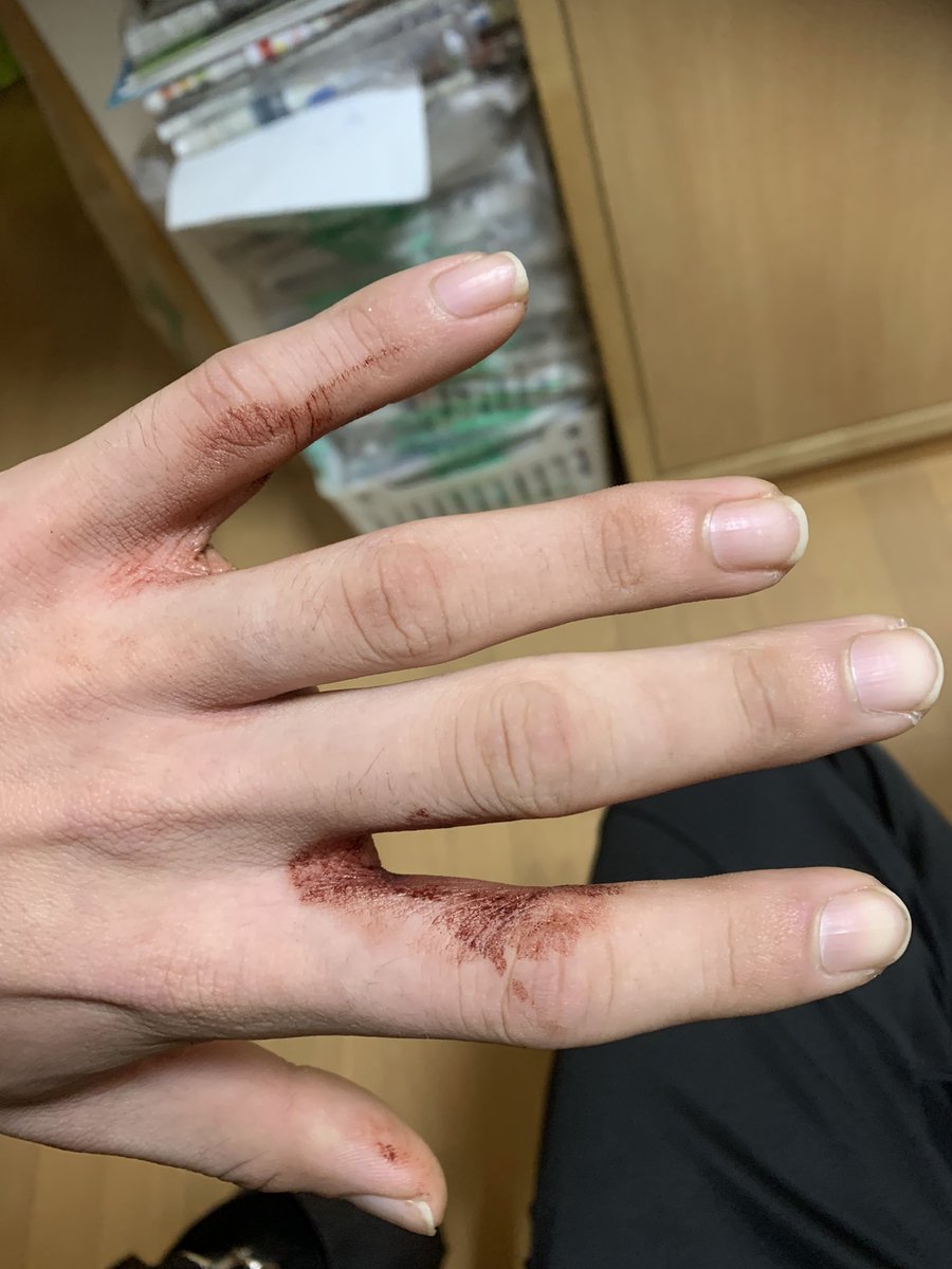 GS400_0TK6's tweet photo. 奈良西警察署の刑事に
暴行受けた😆

なにもしてないのに
お前なんか眼中にないとか言われた
捕まれよまじで https://t.co/OouqRrxhro
