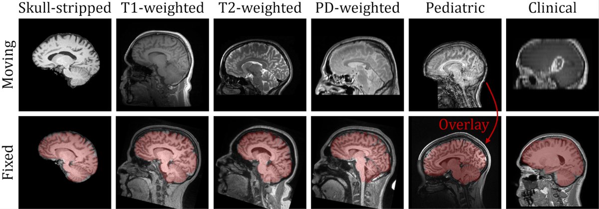 mh3936's tweet photo. We made SynthMorph an easy-to-use tool for end-to-end brain registration without preprocessing. Available for #Docker at https://t.co/1I0iXrLtTB and in the nightly @FreeSurferMRI dev build. With @AdrianDalca et al. at @MIT_CSAIL @MGHImaging @MGHMartinos. https://t.co/srWWpihoy2