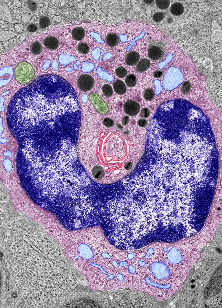Have you seen an #eosinophil developing in the bone marrow?🤩🔬  Learn more: tinyurl.com/ultrastructure
#EMMonday #sciart #ImagingTheFuture