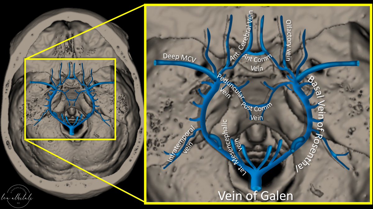 Think you know brain vascular anatomy? How many brain vascular circles do you know? Everyone knows the Circle of Willis, but few know its venous counterpart: Venous Circle of Trolard, important in dural AVF Can you see the polygon on top of a❤️? #medtwitter #neurotwitter #meded