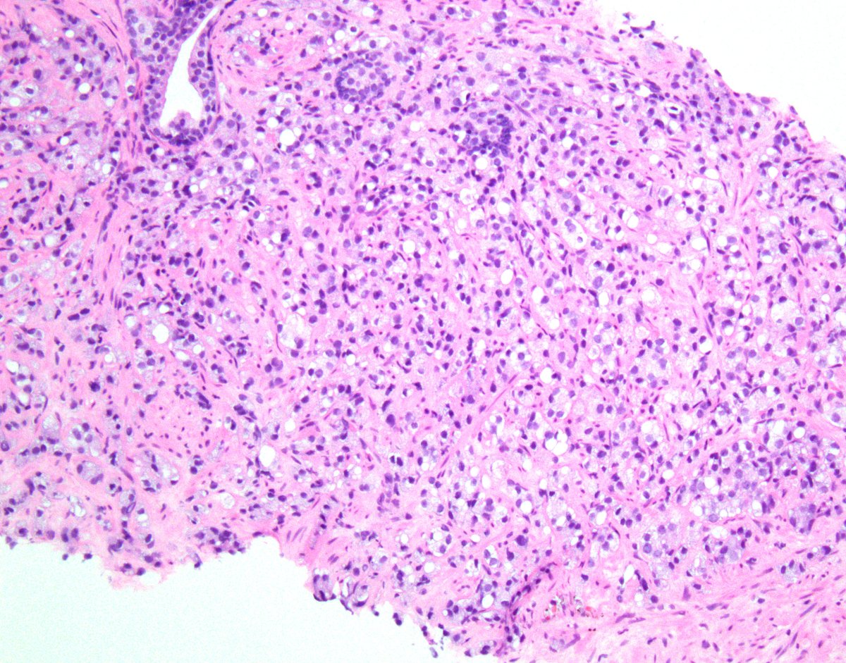 Samson W. Fine, MD tweet media