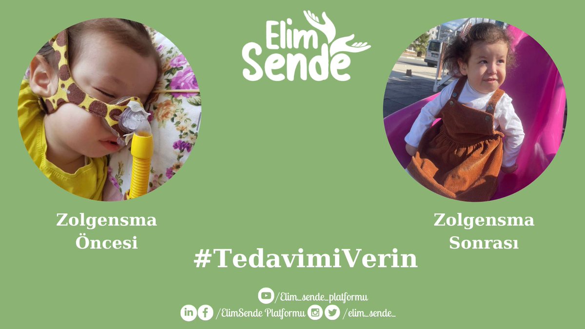#TedavimiVerin <a href="/AmineyeU/">Amineye_umutol</a>  ilacını alan ve çok güzel gelişmeler sağlayan bebeklerimizden <a href="/drfahrettinkoca/">Dr. Fahrettin Koca</a> <a href="/saglikbakanligi/">T.C. Sağlık Bakanlığı</a>  Bakanım lütfen görün zolgensma alan bebeklerimizi <a href="/elim_sende_/">elimsende</a>  zolgensma kritersiz olarak sgk kapsamına alınsın