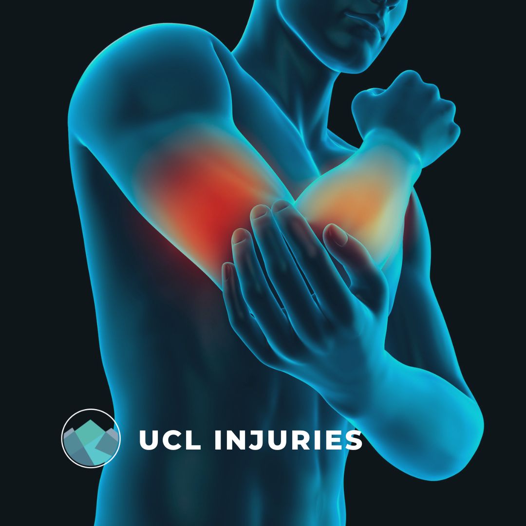 ⚾️ 🏈 💪 Ulnar Collateral Ligament (UCL) Elbow Injuries are common among throwing athletes like quarterbacks and pitchers, and combat athletes. 

#elbowinjury #injury #elbowpain #ucl #ulnarcollateralligament #sportsmed #sportsdoc #pt #pdx #portland #pnw #qb #pitcher #injuredelbow