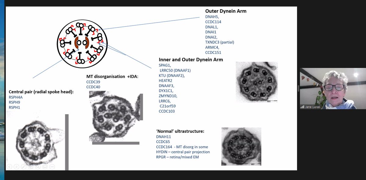 PCD_UK's tweet photo. Cilia or pizza?
Great talk by @JaneSLucas1 on #PCD and how your particular genetics might affect the severity your PCD symptoms.
#cilia #primaryciliarydyskinesia #tem #microscopy #pizza #support #scicomm #PCDLive https://t.co/161JOFA9oT
