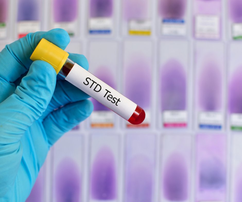Ask us! Testing for Hepatitis B and Hepatitis C is done right in our office in #STLOUIS Call for your appointment. #STL #ExploreSTL #MISSOURI #STLMADE #UMSL #SLU #HSSU #STLMADE