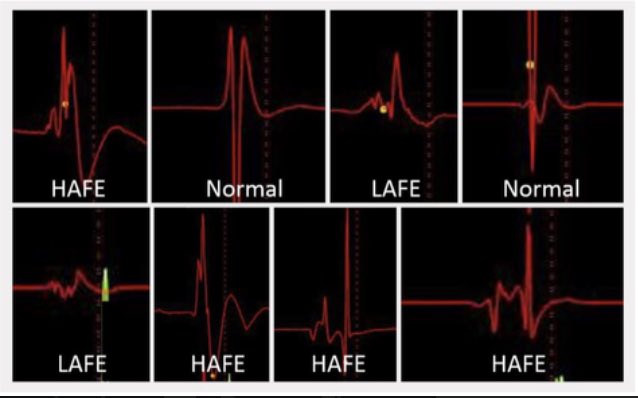 Tolga Aksu, MD tweet media