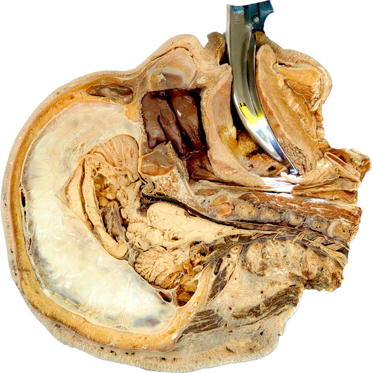 The Protected Airway Collaborative tweet media