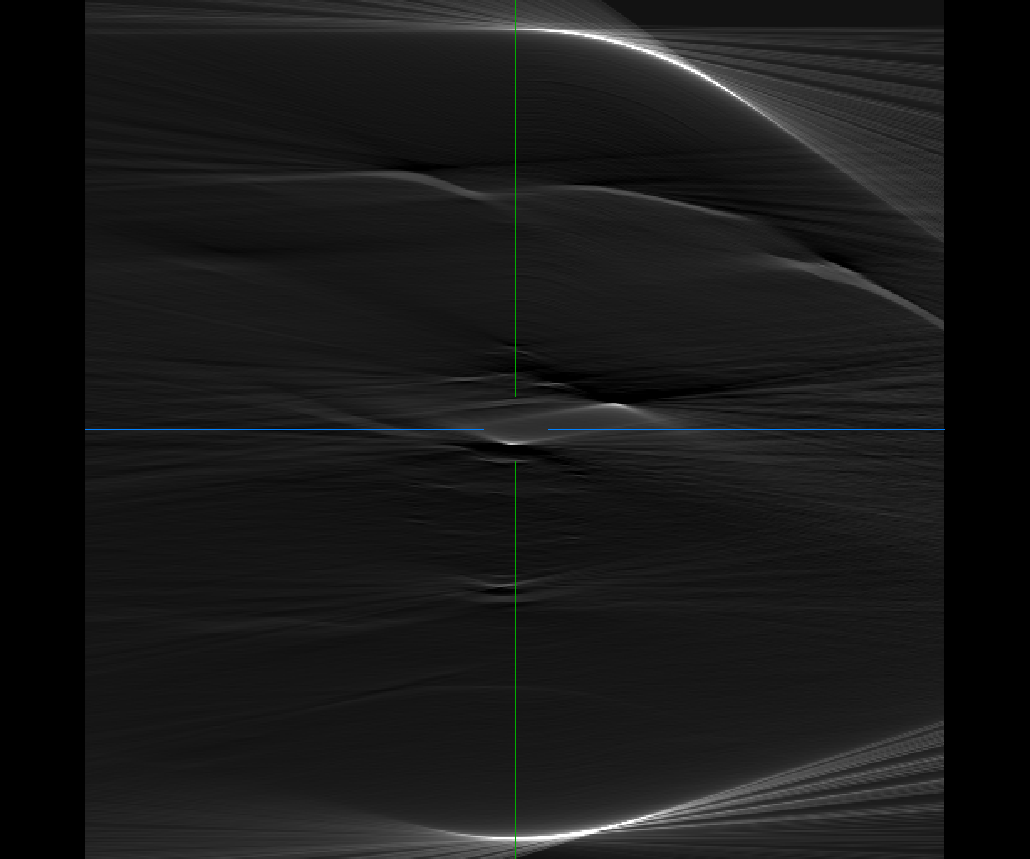 ___oxi___'s tweet photo. I think my script has magic bugs. The sinograms looks nearly the same, but when i reconstruct the ct one is garbage. There is no code between creating the sinograms and creating the ct image and the differences of the sinogram can't have such great impact on the ct image. https://t.co/kCZ2Hh9pIM