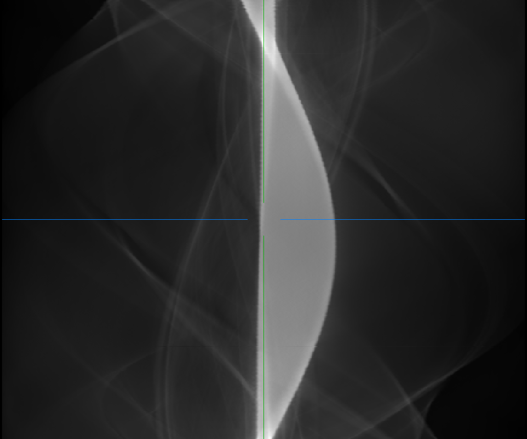 ___oxi___'s tweet photo. I think my script has magic bugs. The sinograms looks nearly the same, but when i reconstruct the ct one is garbage. There is no code between creating the sinograms and creating the ct image and the differences of the sinogram can't have such great impact on the ct image. https://t.co/kCZ2Hh9pIM