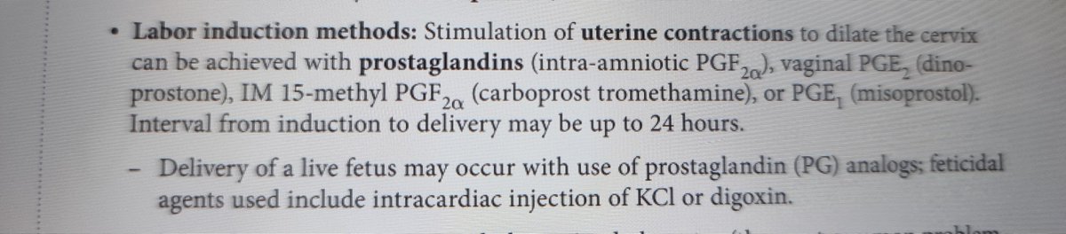 Q: Define murder?
A: