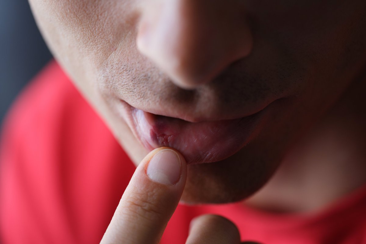 SmileFactorygt's tweet photo. ¿Sabías qué la cavidad oral es un semáforo que indica en qué “color” está tu salud general? 

Hay muchas manifestaciones de enfermedades serias que presentan signos en boca y si se detectan tempranamente, pueden evitar el desarrollo de condiciones delicadas. https://t.co/joiYI9Ekic