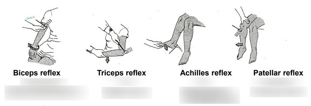 med_712's tweet photo. How take reflexes in 30 seconds https://t.co/mcxPfIQiu4