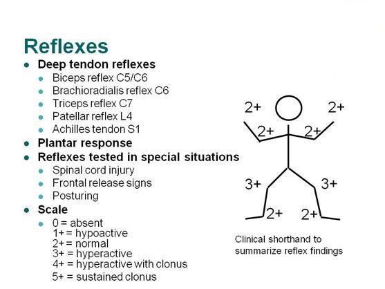 med_712's tweet photo. How take reflexes in 30 seconds https://t.co/mcxPfIQiu4
