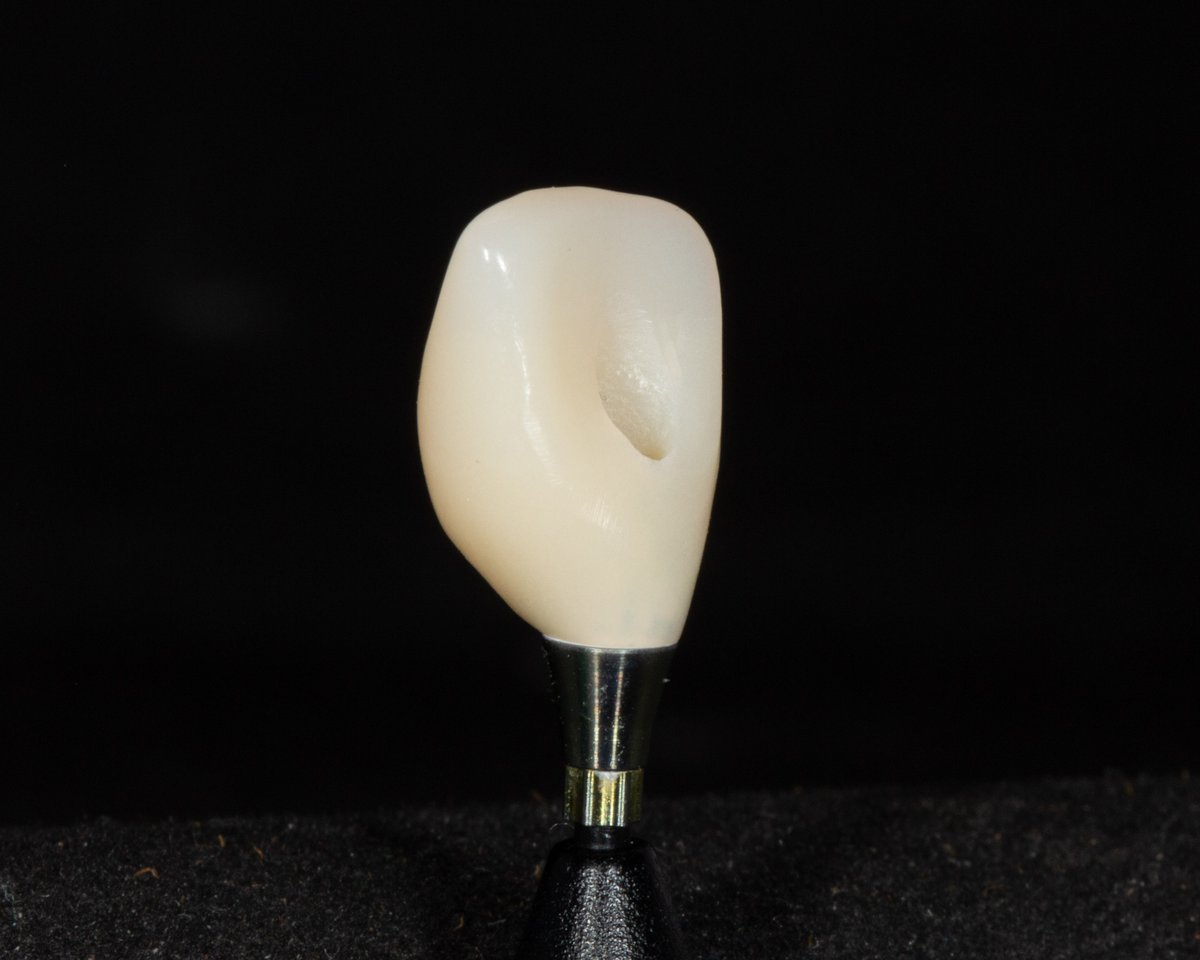 Hallmark Dental Lab tweet media