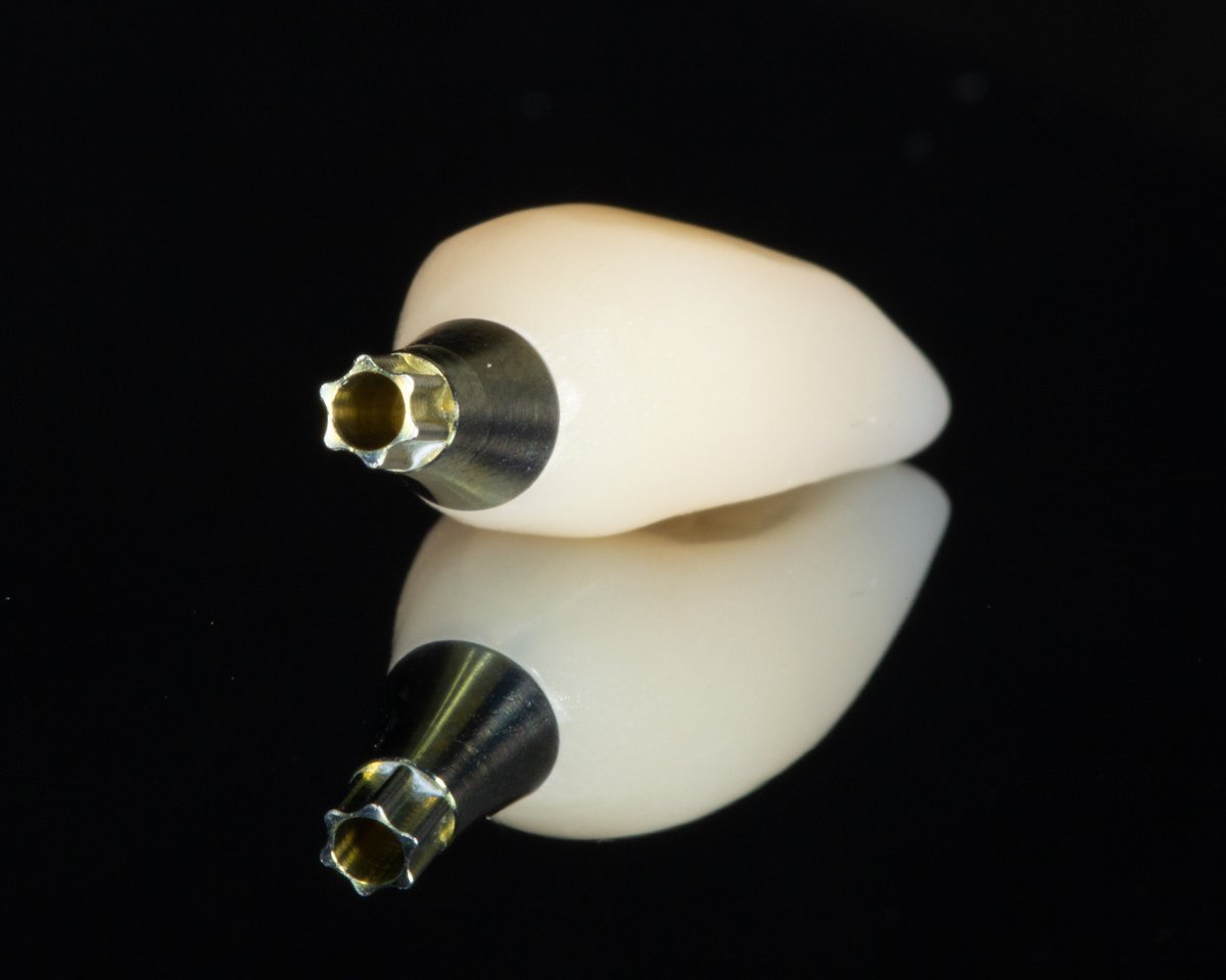 A PMMA temporary is an excellent option for controlling gingival healing after implant placement.