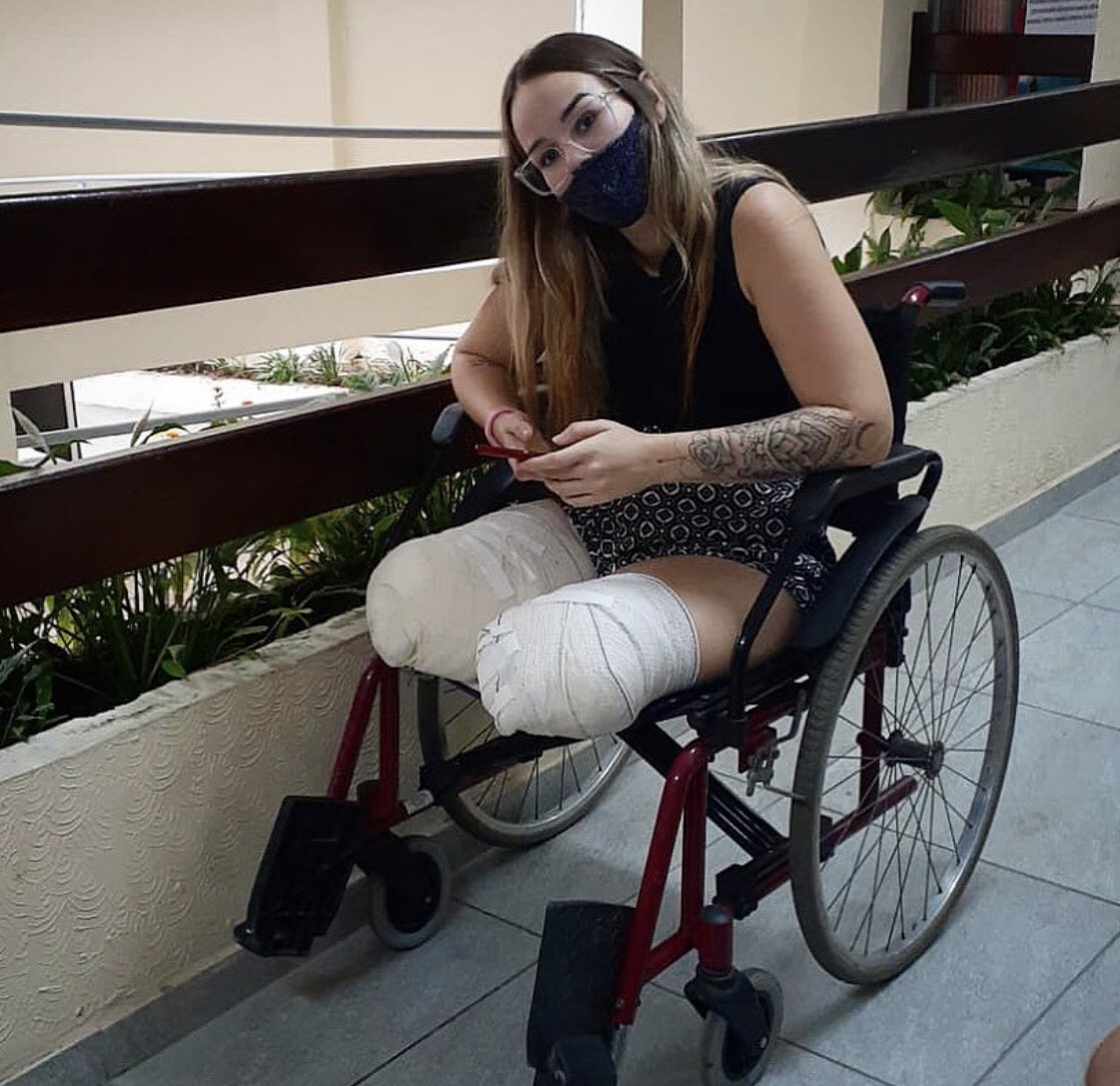 euthaynafreire's tweet photo. Gente bora puxar mais uma corrente do bem? Essa é a Renata, no dia 08/07/2021 ela sofreu um acidente de carro junto com seu noivo, o motorista que provocou o acidente estava embriagado, ela perdeu 1 das pernas na hora e a outra precisou ser amputada,
RENATA PRECISA DE PRÓTESES+ https://t.co/3HfDQHWtUA