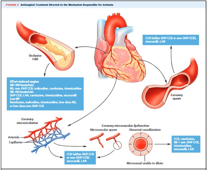 Zill_cardio's tweet photo. Evolving Management Paradigm for Stable Ischemic Heart Disease Patients: JACC Review Topic of the Week.

@jaccjournals #CardioTwitter #CardioEd 

https://t.co/s7KlpkYXJC https://t.co/j0B81Ug2Oh