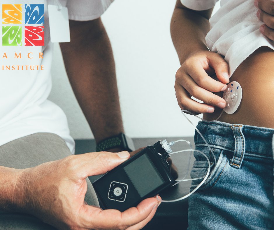 GREAT NEWS: Medtronic has released a new Extended infusion set that can be worn for up to 7 days using an Extended reservoir! 

Learn more: bit.ly/3DrIfmH

#myAMCR #InfusionSet #InfusionSetChange #Type1Parents #DiabetesManagement #DiabetesNews