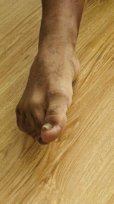 1 pic. Exige cuerpo de gimnasio pero tiene las uñas así: https://t.co/zliRKhi6lM