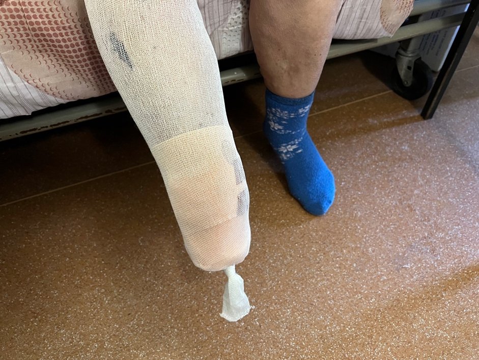 New <a href="/hrw/">Human Rights Watch</a> report details civilian harm &amp; suffering from antipersonnel #landmines in the war in Ukraine hrw.org/news/2023/01/3… It looks at how thousands of PFM antipersonnel mines were fired by rockets into Izium in 2022, when Russian forces occupied the city. <a href="/minefreeworld/">ICBL</a>