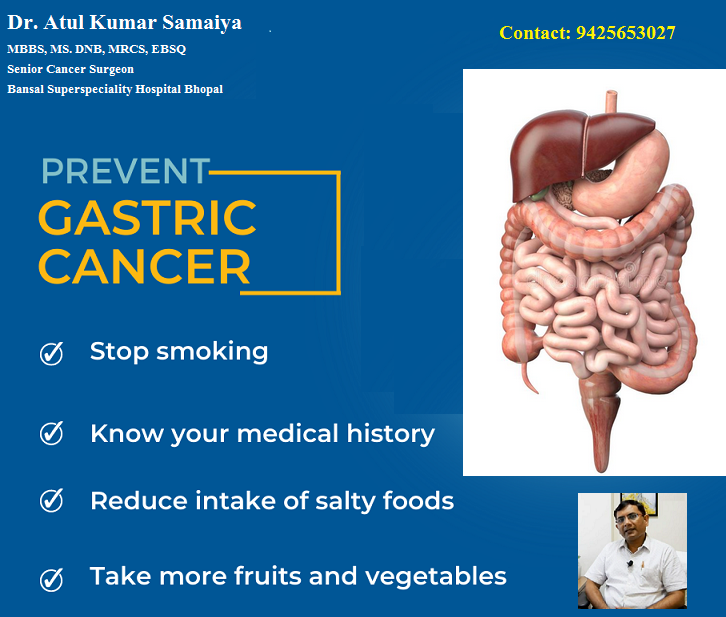 oncologist_bpl's tweet photo. Stomach cancer is also called gastric cancer, it is a growth of cells that starts in the stomach. It is the fourth most common malignancy worldwide.
Here are some tips to prevent gastric cancer!
Contact: 9425653027
Website: https://t.co/D2jm3uhxKV
 #gastriccancer #dratulsamaiya https://t.co/7z7tNwyk0g