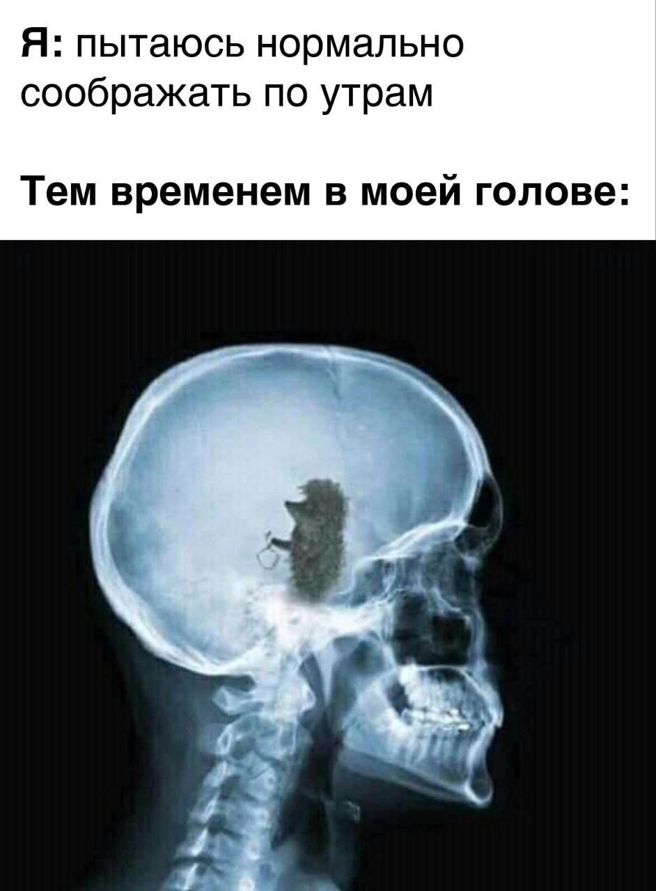 Рентген приколы