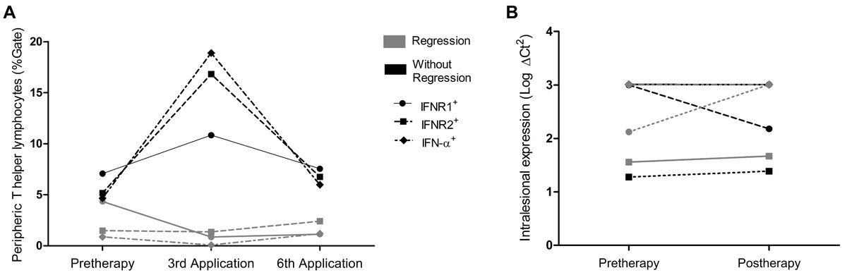 gan_aries's tweet photo. 🙌Welcome to read the publication in @CEOGjournal 

Pegylated-interferon-alpha treatment modulating the immune response of cytotoxic lymphocytes in #cervical_intraepithelial_neoplasia

For more details:
https://t.co/aLuZ4q5jEC

#Immunotherapy   #Interferon-α https://t.co/YqTJNc2jtt