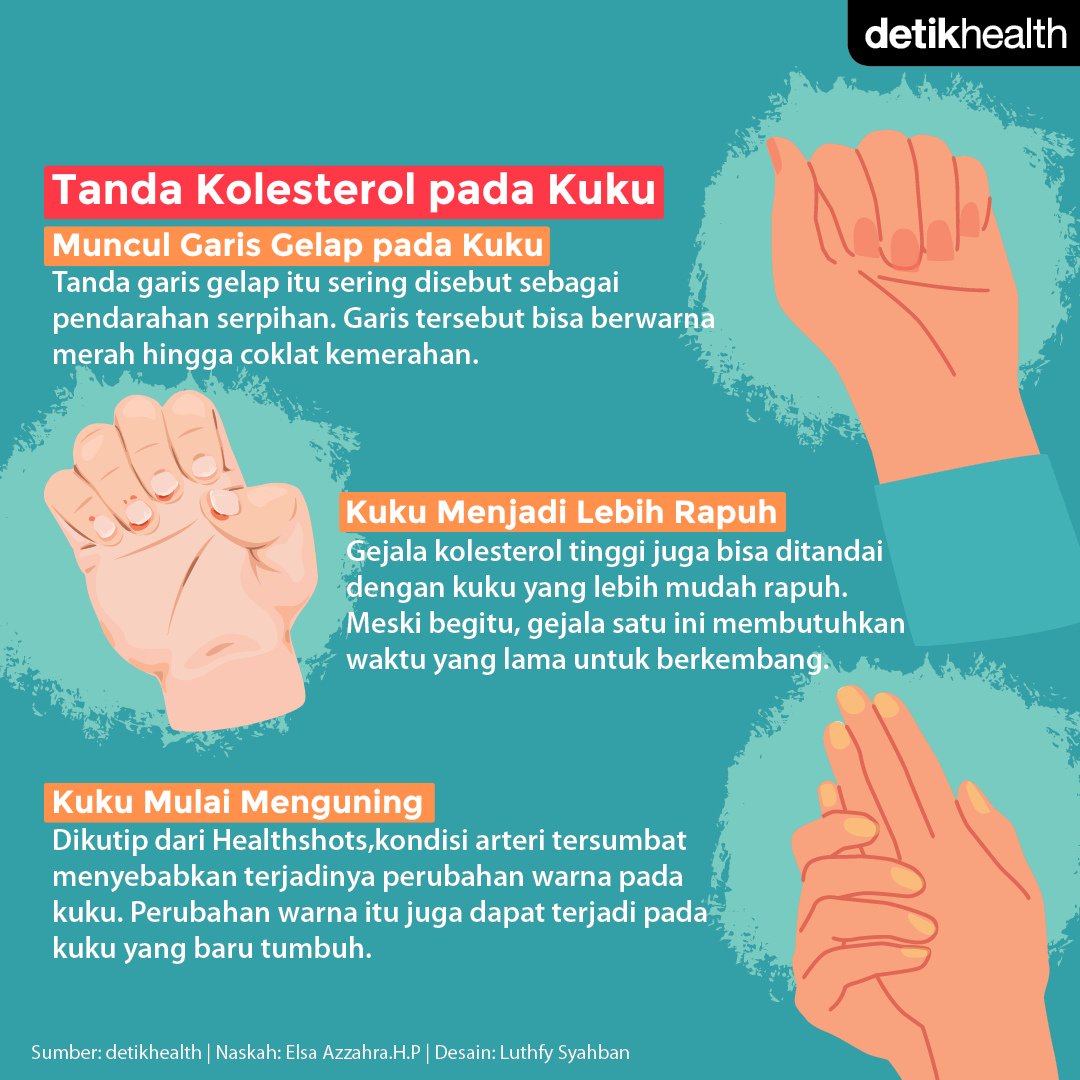 detikHealth's tweet image. Menurut direktur medis di Olio Lusso, Monika Wassermann, tanda kolesterol tinggi bisa dilihat dari perubahan yang terjadi pada bagian-bagian tubuh. Salah satunya bisa melalui kuku lho.⁣

Lantas, bagaimana ya cara membedakannnya? Yuk simak dalam visual berikut!
