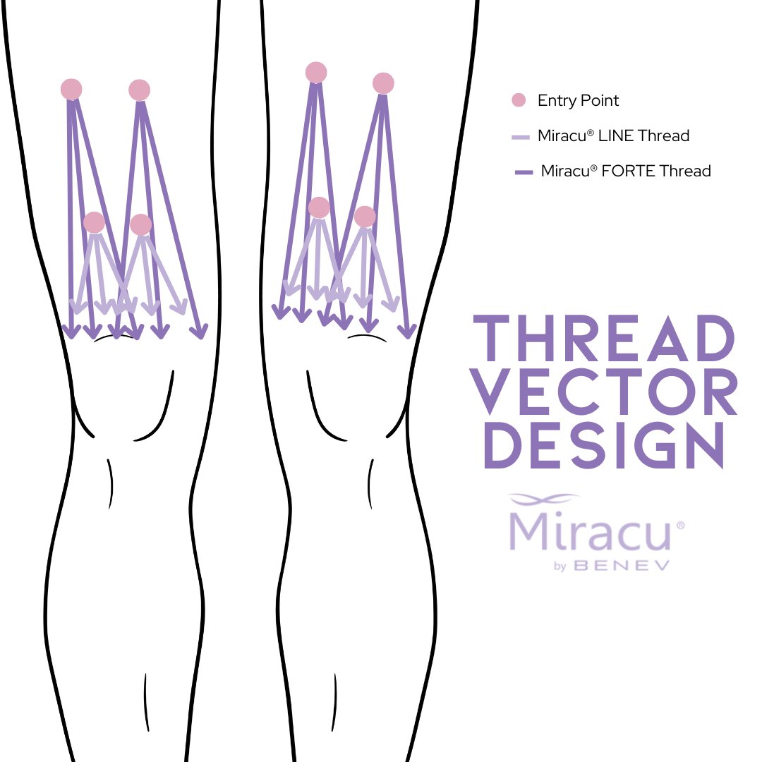 When it comes to revitalized knees, Scott Callahan, PA-C develops custom treatments that are just the bee’s knees! 🐝💜 Check out his master technique using Miracu® PDO threads.

#miracu #miracupdothreads #benev #pdothread #pdothreads