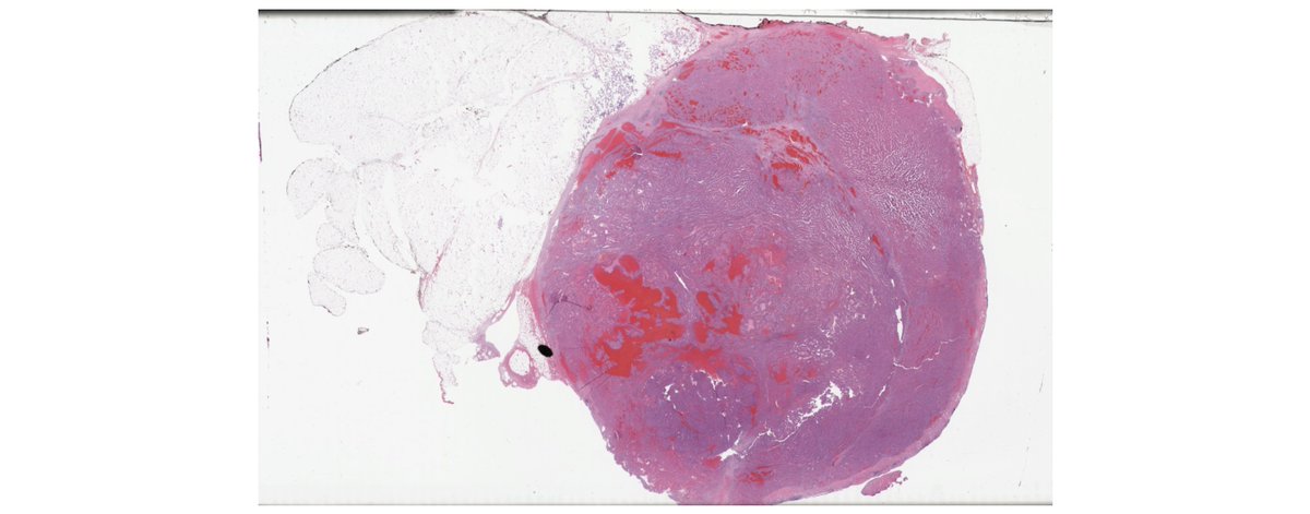 Increased #pathologist productivity and #BloodCancer #DiagnosticCapacity, as well as supporting better targeted #therapeutics are all things that our #ArtificialIntelligence #DigitalPathology technologies can do.

Get in touch to help.

#HealthcareStartup #StartupInvesting