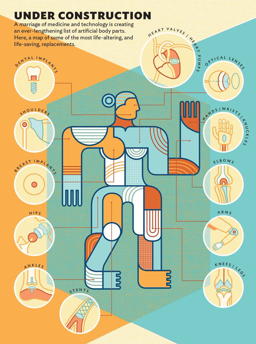 i2iart's tweet image. Medicine meets technology in this illustration by @AutomaThom highlighting a number of life changing body replacements
#science #technology #medicine #surgery #illustration #illustrator #digitalart #digitalartist #editorialillustration #i2iart
i2iart.com/thom-sevalrud