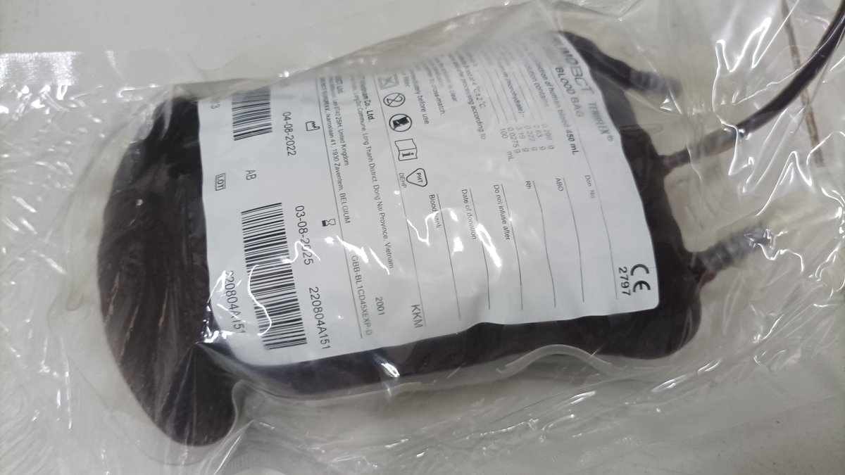JDevonshire's tweet image. I was contacted by the @philredcross earlier as someone desperately needed my blood. I'm O- which is extremely rare in the Philippines (less than 1% of the population). The person's family drove several hours to collect this bag earlier

#Rhnegative #giveblood #givebloodsavelives