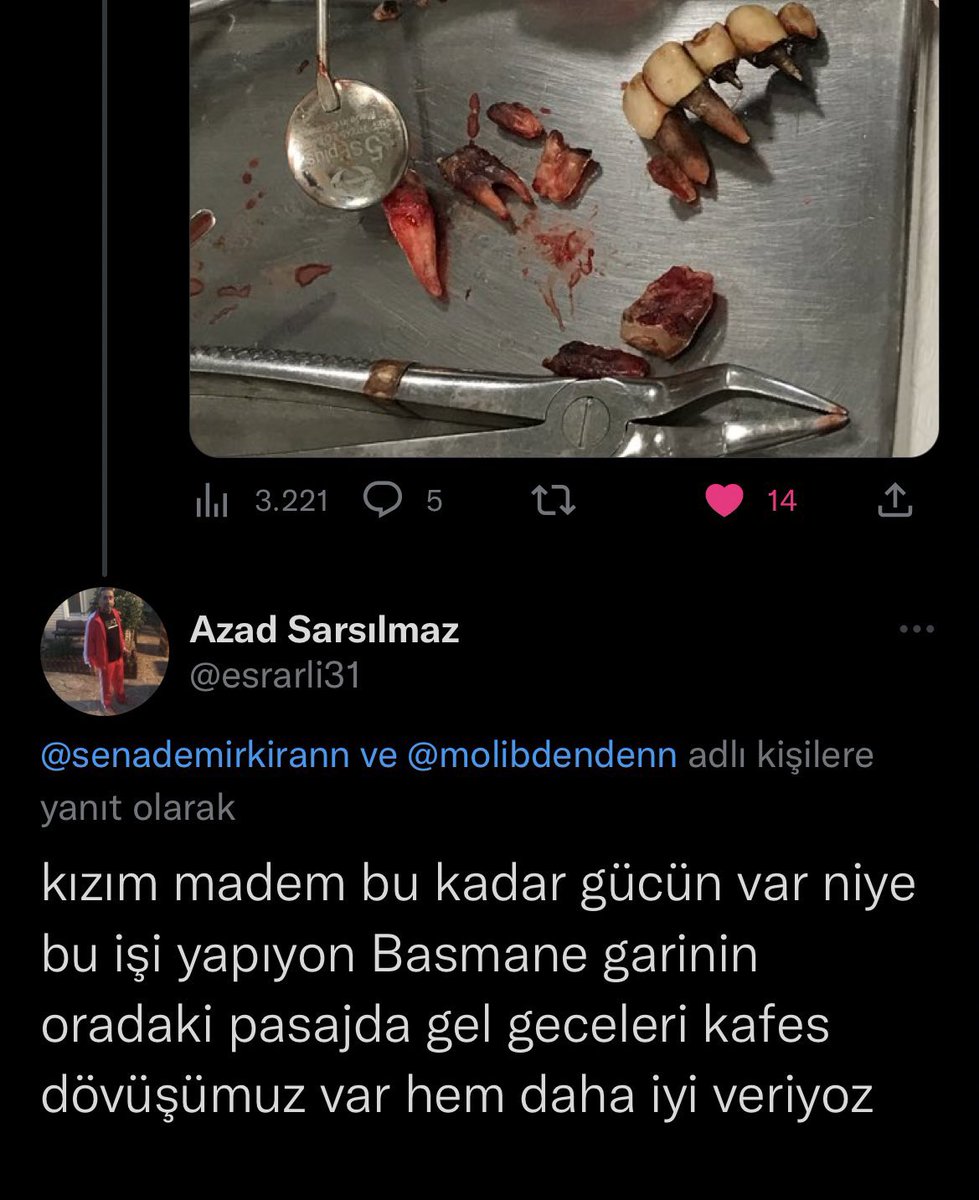 Zorlu bir diş çekince hissettiğim