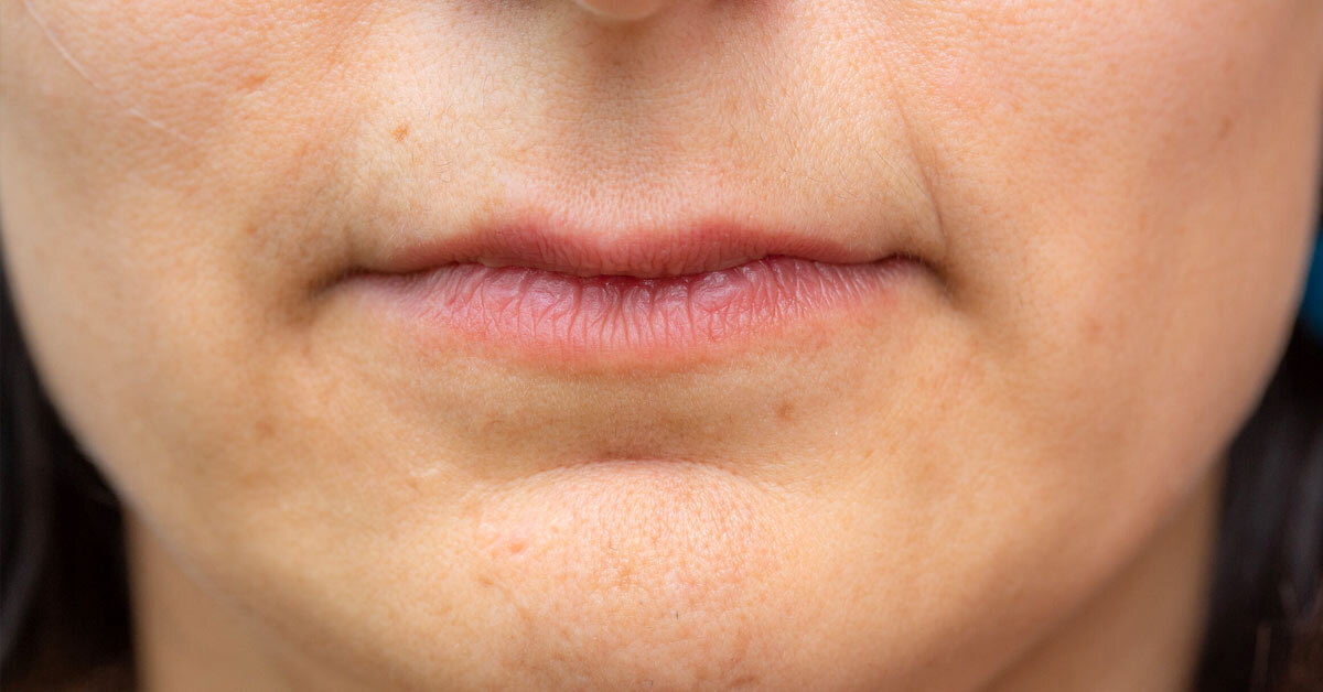 morbiids's tweet photo. not even trying to be rude but how does it feel to have lips like this 

like what does it feel like to kiss https://t.co/Or36yNvA5W