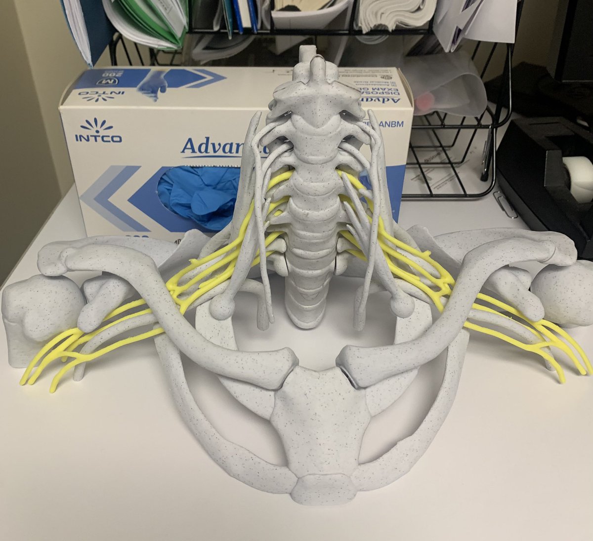 ccurtinprs's tweet image. Great day in clinic my patient gave me a 3-D printed plexus!!!   Also a bunch of pocket plexi so you are always ready     for whatever comes your way 😉 #brachialplexus #nervenerds