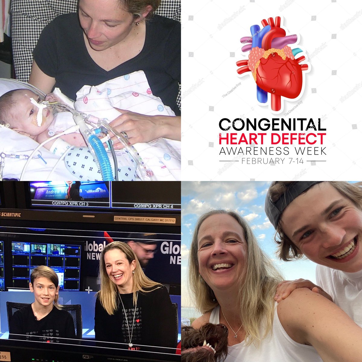 Just a mom and her CHD kid. Congenital Heart Disease is common and critical. Thanks for being #CHDAware this Valentine's Day! #CHDAwarenessWeek #chdheartwarrior #chdheartmom <a href="/Childrens_Heart/">childrens_heart</a> Thanks for following and commenting this last week ❤️