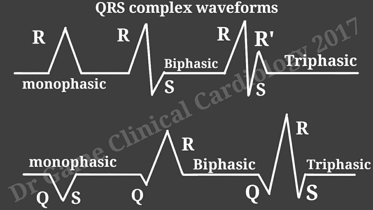 DoctorGame99's tweet photo. QRS complex waveforms #ECG #cardiology #esc #MedTwitter #FOAMrad #FOAMed #FOAMcc #USMLE #CardioEd #CardioTwitter #echofirst #ecgbot #echobot #medicalstudent https://t.co/g7q7seCYuB