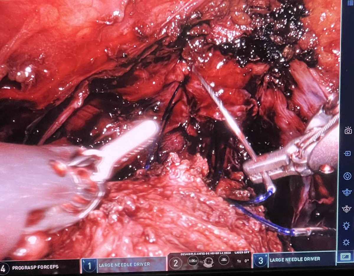 mdmancebo's tweet photo. Comenzando la mañana junto al Dr. Valle en Asturias!!! @vivishdiep #UroSoMe #Robotics https://t.co/0eXfDwbuMe