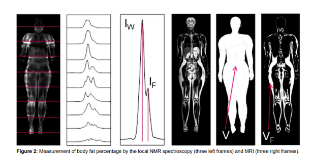 Measurement of Fat Content in the Human Body by Nuclear Magnetic Resonance..by Yury A. Pirogov, DSc, (Phys &amp; Math)  [ISSN 2377-8385].

Read the full article here: bit.ly/3Hdz1wS

Submit your manuscript:bit.ly/3GNx61Q

#openventio #OpenAccess #MRI #fattyissue