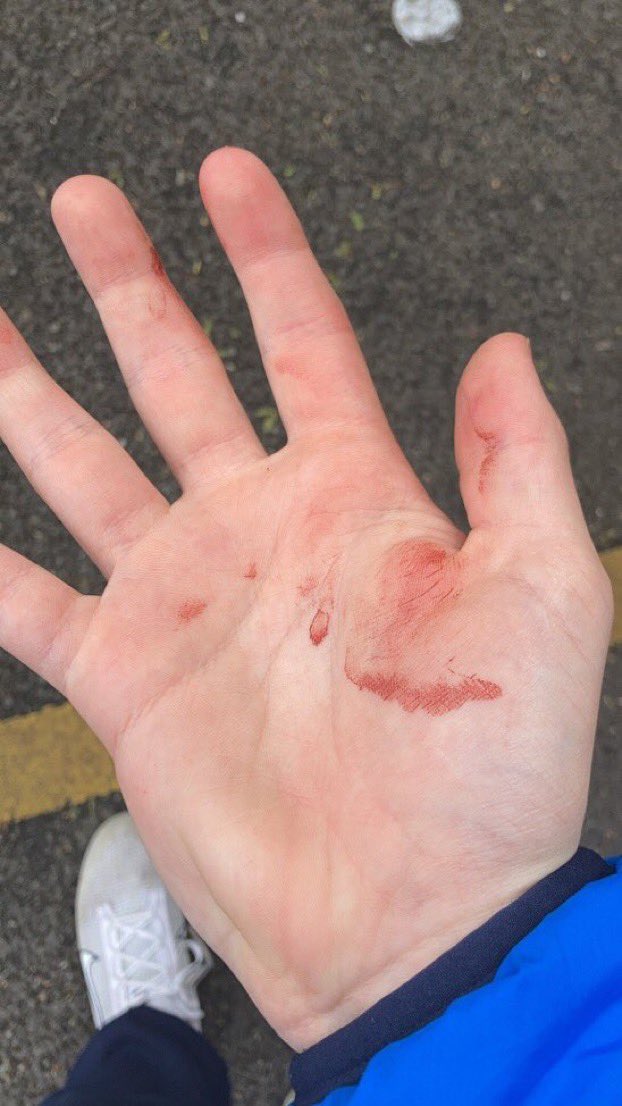 stevenKloppLFC2's tweet image. First Blueshite on the concrete this morning 👊🔴 #LFC