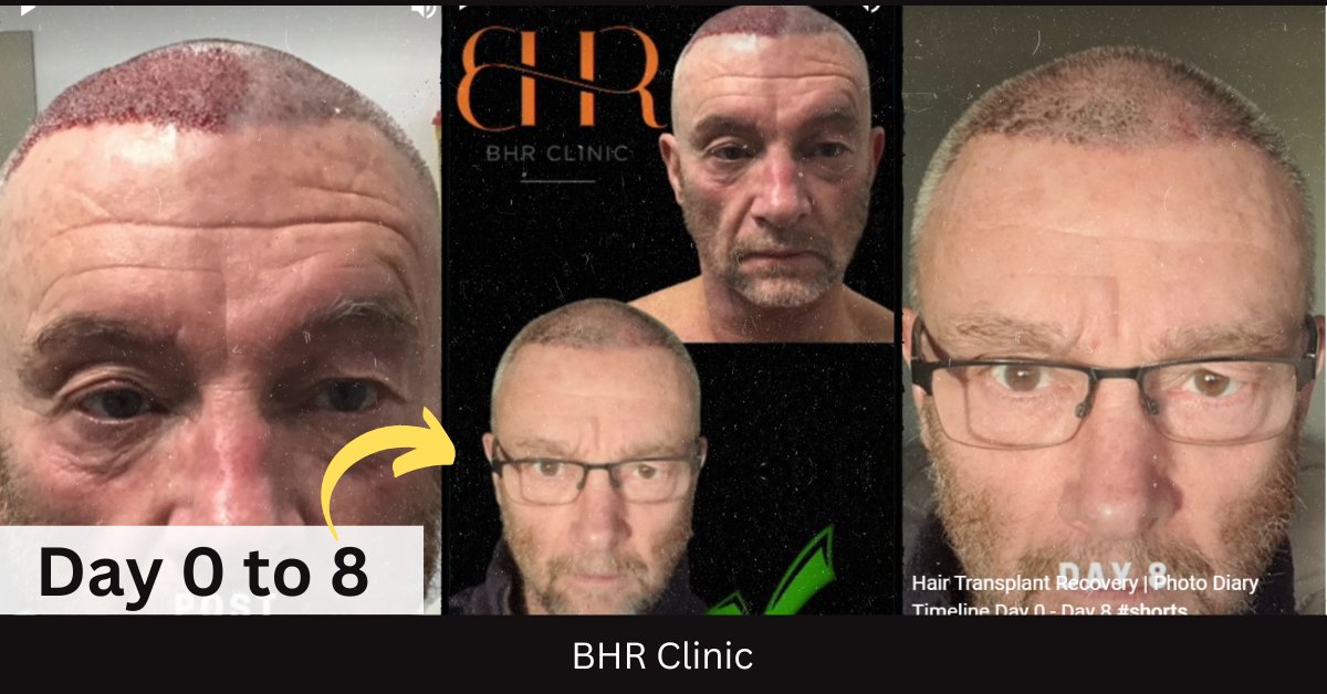 BHR Clinic (Bisanga Hair Restoration) (@BHRClinic) / Twitter