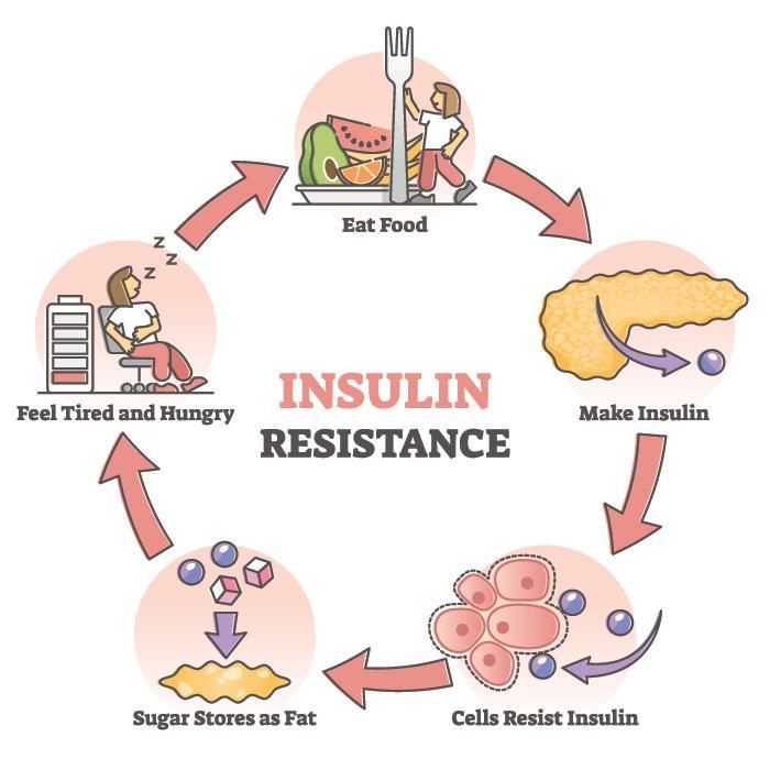 KristenJakobitz's tweet photo. Insulin resistance is strongly associated with #heartdisease, which is the leading cause of death across the globe. https://t.co/IEyhXnA9c4

Ways to reduce insulin resistance:

Reduce added sugar
Exercise
Eat more whole foods
Quit smoking
Sleep 7-9 hours nightly

#health https://t.co/xthfTmoVNW