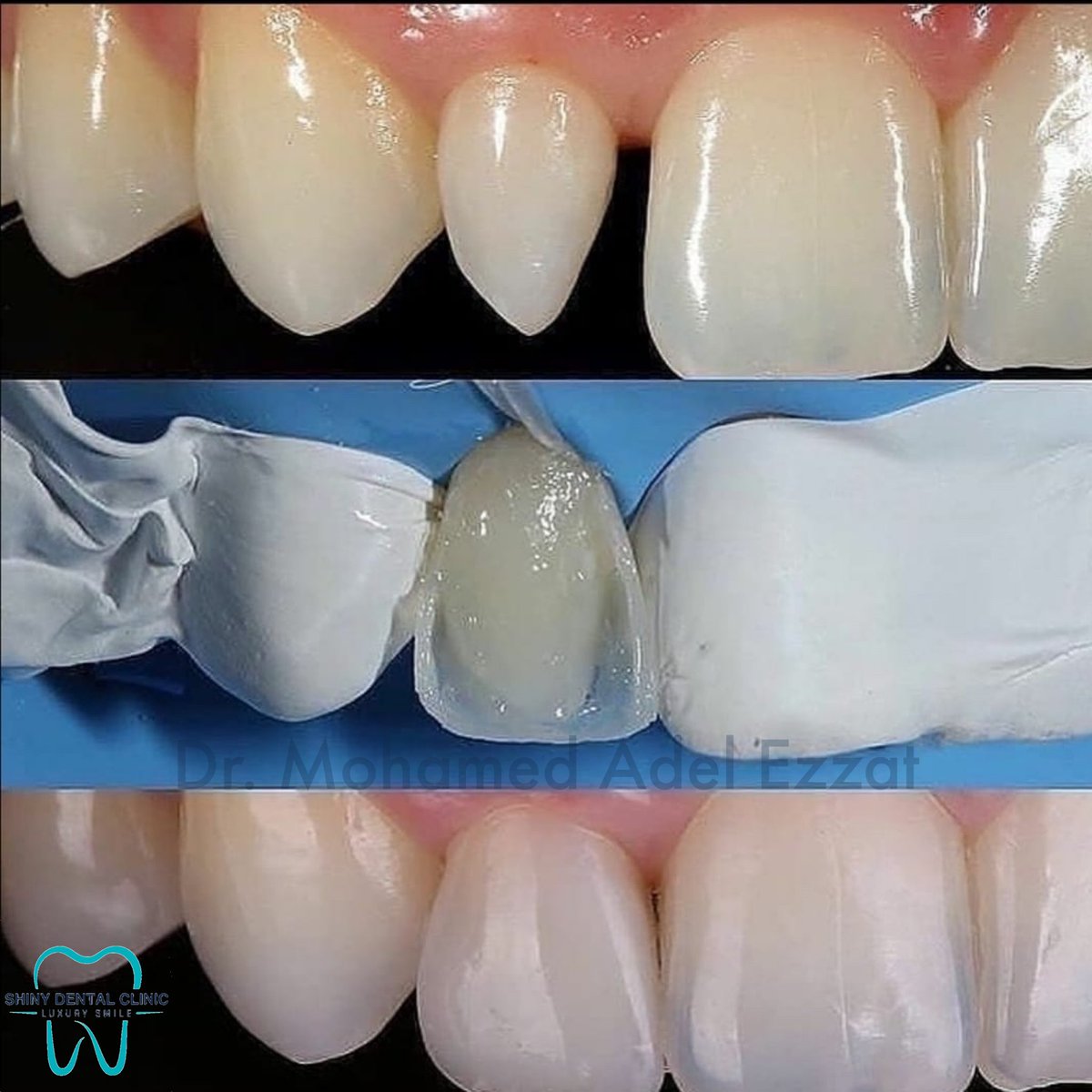 urfavdentist0's tweet photo. Unique..!✨ https://t.co/b3pVarPkhh