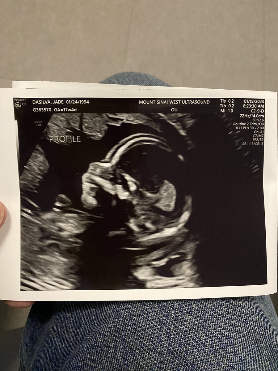 Rafael Cesar DaSilva tweet media