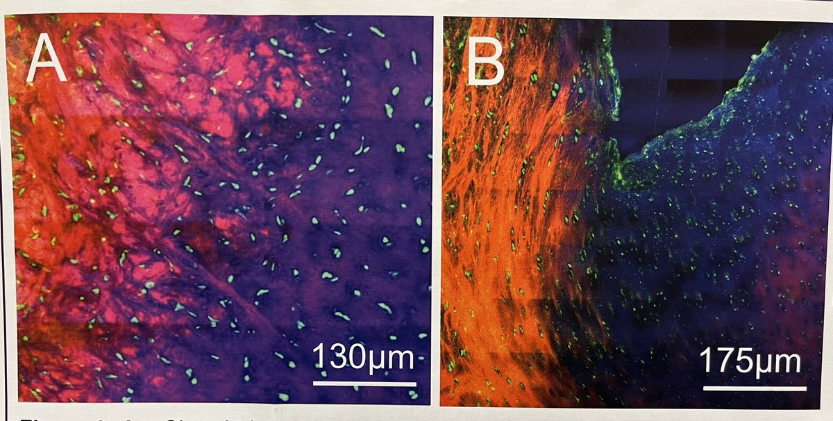 sophie__w's tweet photo. I am super biased, but I think @MuditGGX has some of the prettiest images at #ORS2023, generated during a brilliant placement at Exeter University. Talk to him at poster 1758 to find out what they tell us about labral tears. @Dr_H_Fermor @AlisonJonesLds @iMBE_Leeds https://t.co/0YnOlSDp0o